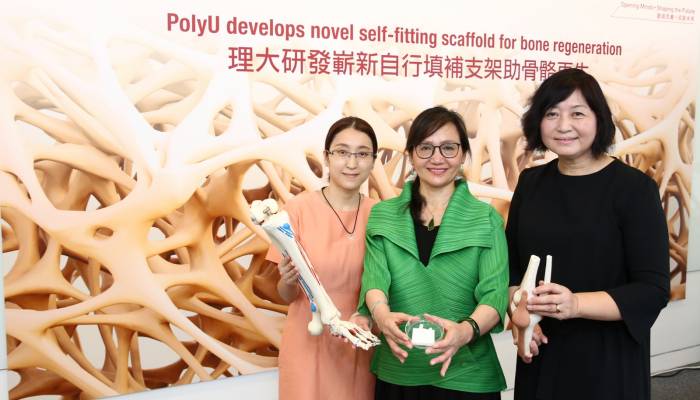 The research team led by Professor Hu Jinlian (centre), Dr Xie Ruiqi and Dr Guo Xia (right) have developed a novel self-fitting scaffold which can be safely and conveniently implanted into bone defects and induce bone regeneration.