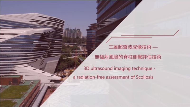 3d ultrasound imaging thumbview