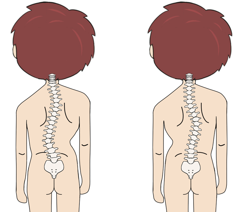 spine shape