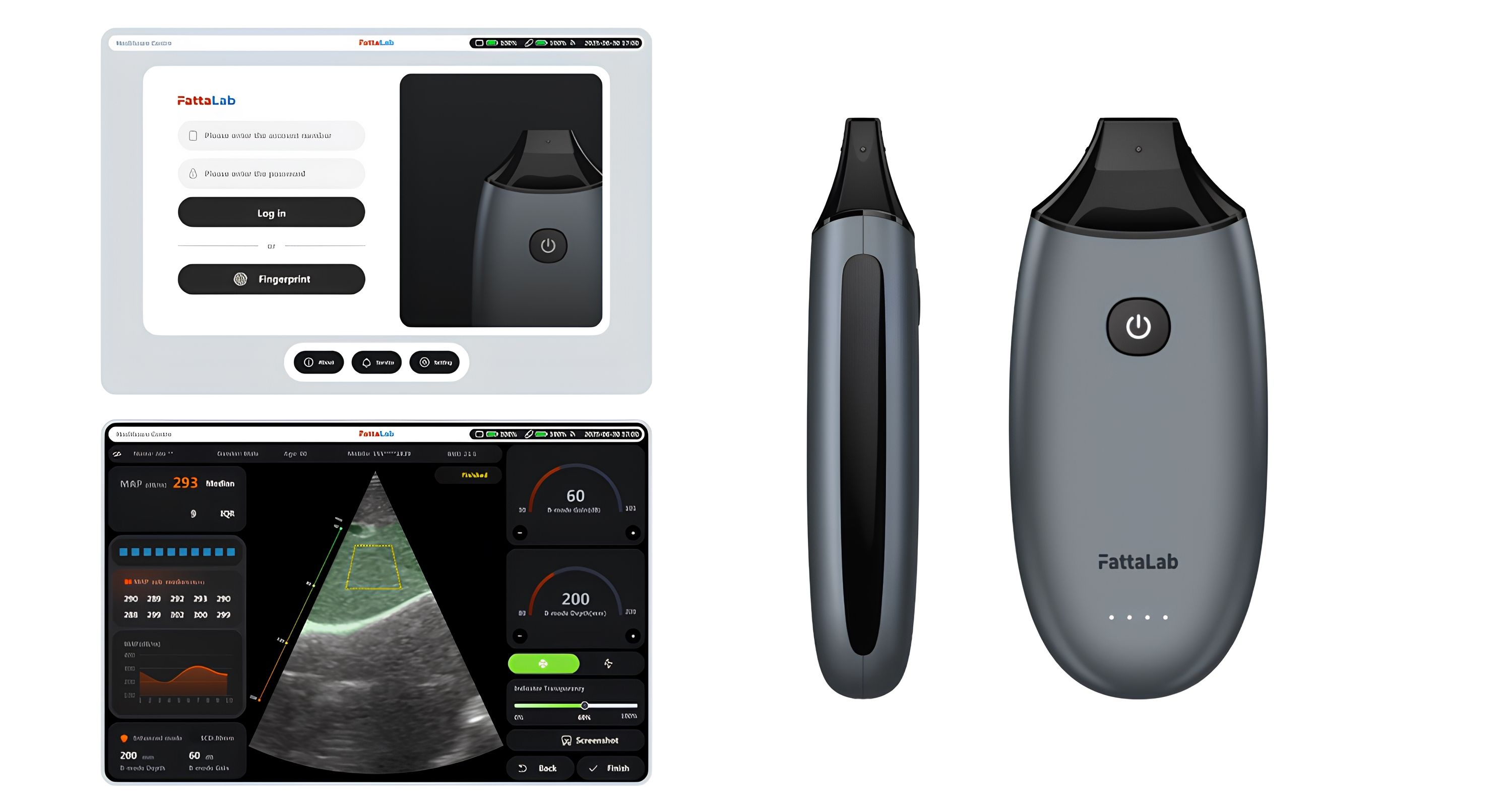 「FattaLab®肝脏脂肪测量仪」由理大梁显利生物医学工程教授丶生物医学工程学系讲座教授丶意领科技有限公司创始人兼首席科学家郑永平教授领导研发，是全球首款具医疗级精准度的轻巧型脂肪肝检测系统。
