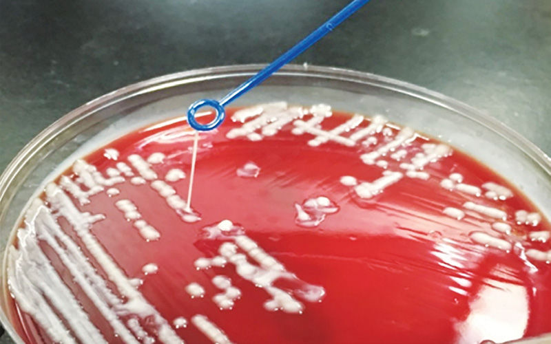 ST11 CR-HvKP strains possess a mucoid outer layer, enabling them to adhere to medical device surfaces, causing transmission in the hospital.