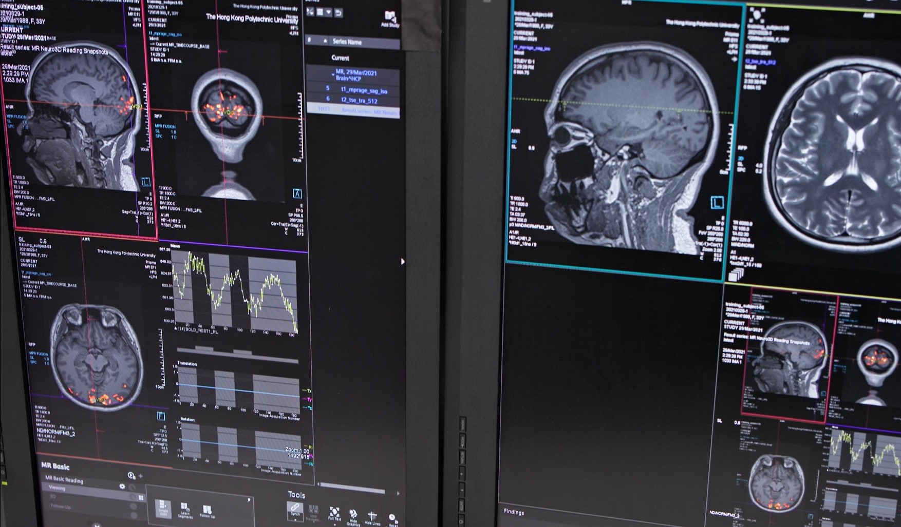 Prof Li_video capture_02