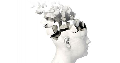 Excel5dementia