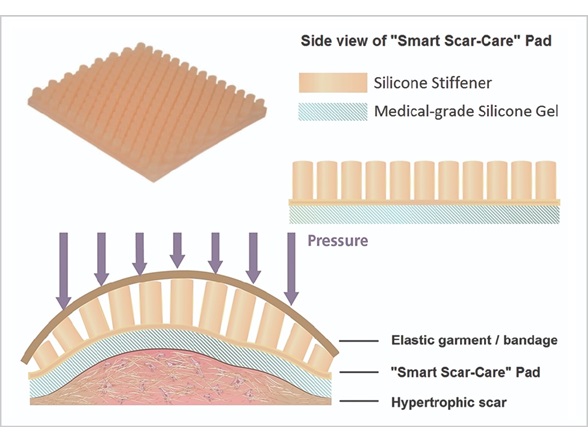 Smart Scar-Care pad