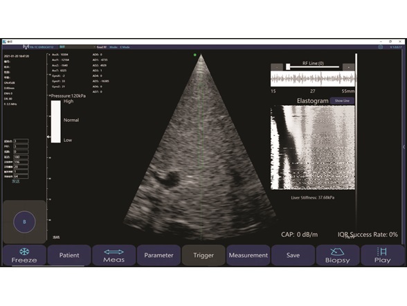 3-Liverscan interface image