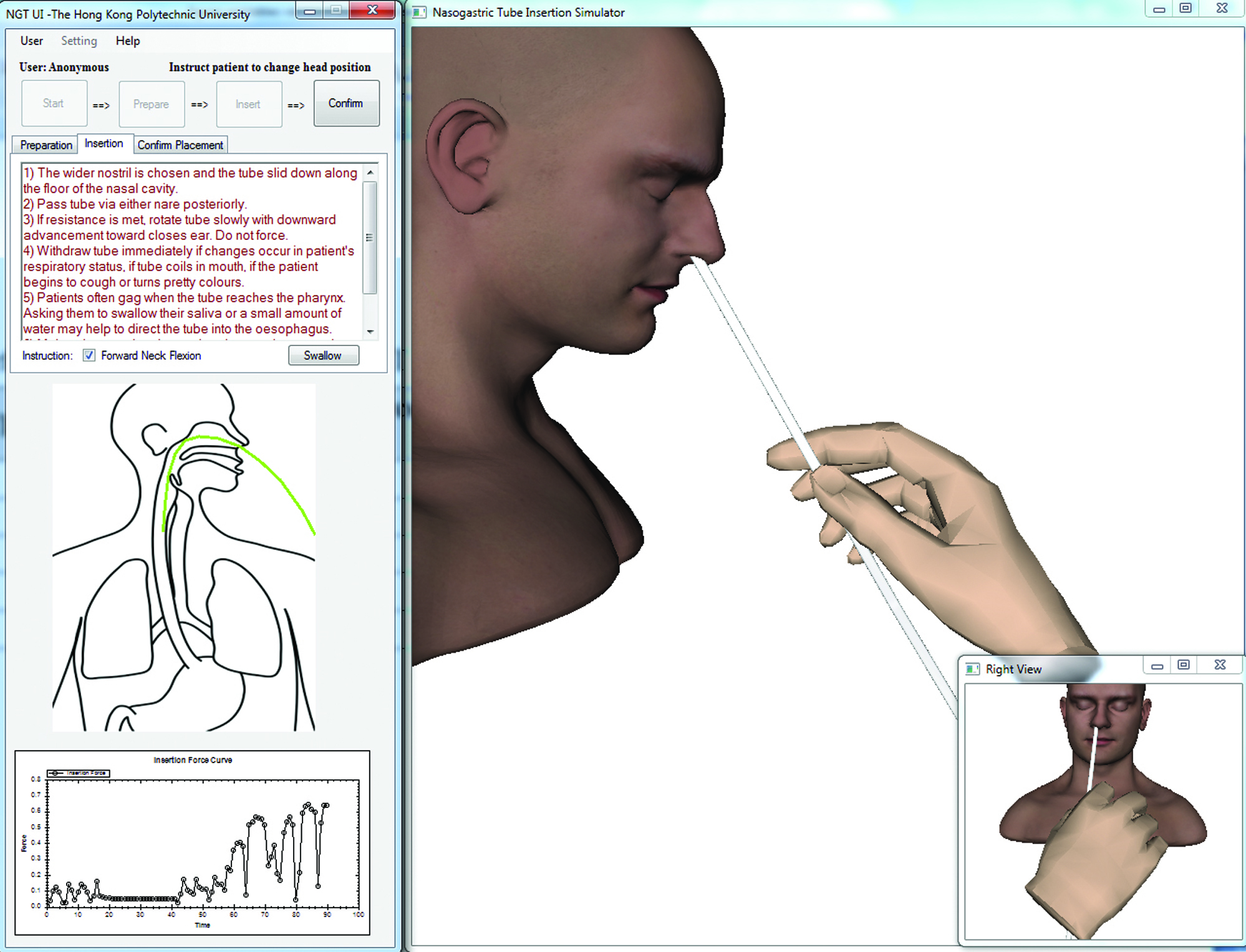Fig 2 Graphical user interface