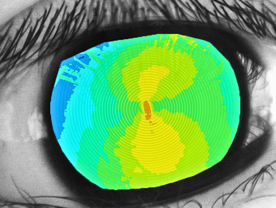 Good Vision Photo _1176x884