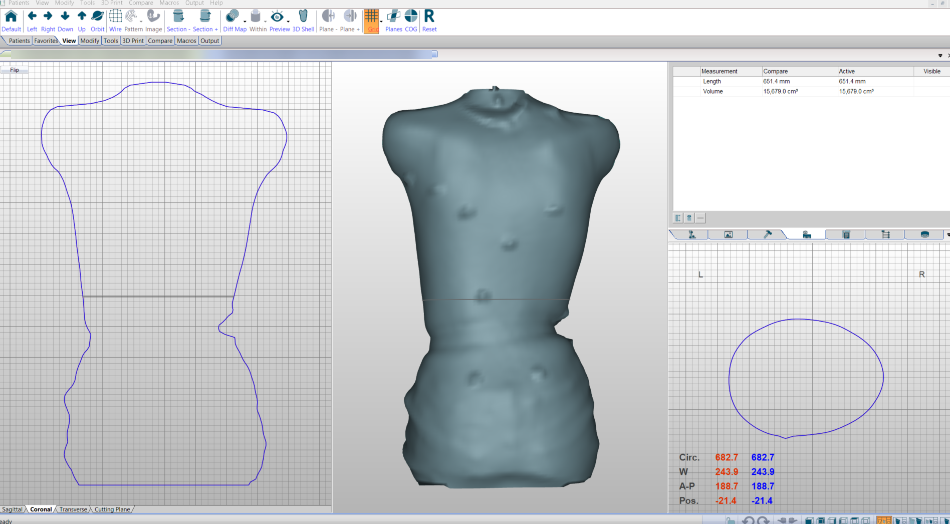 3D Scanner with scanning software and CAD/CAM shape modification ...