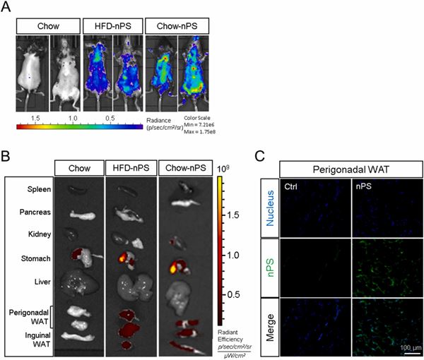RA01_nPS in adipose tissue