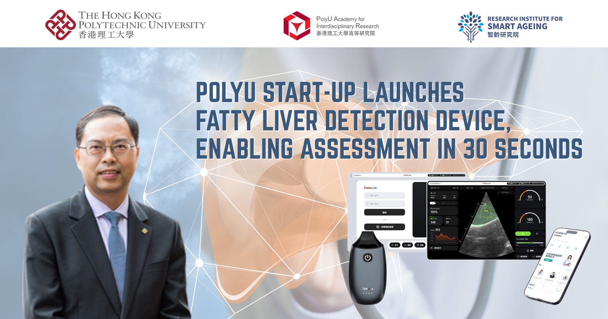 20250705 PolyU start-up launches fatty liver detection device_EN