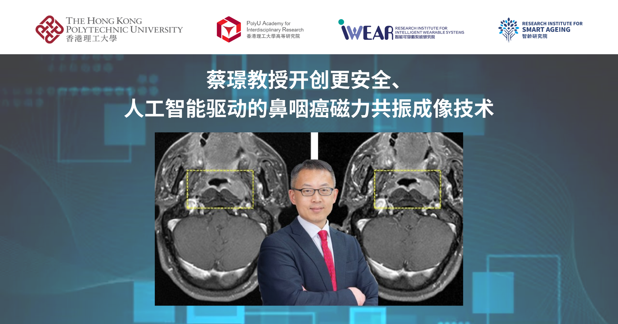 20250814_Prof CAI Jing pioneer safer AI-powered MRI imaging for nasopharyngeal carcinoma _SC