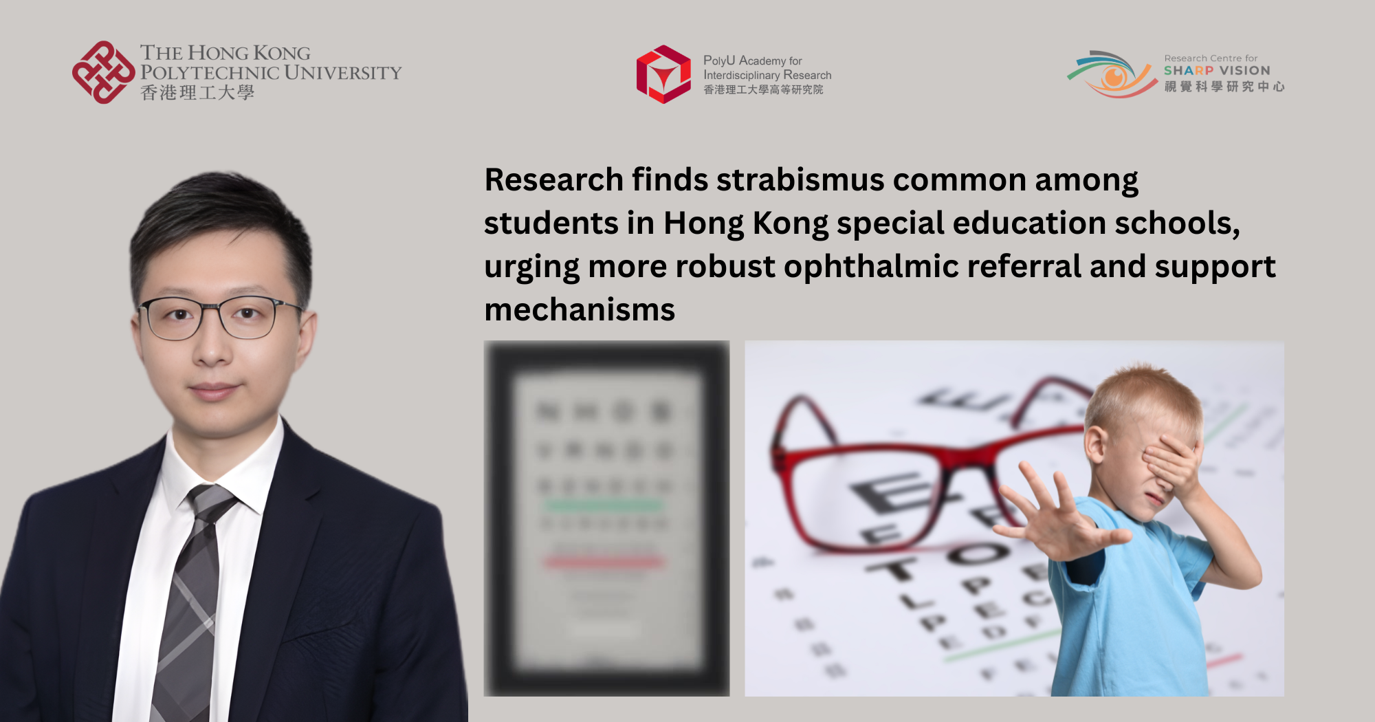 Research finds strabismus common among students in Hong Kong special education schools, urging more robust ophthalmic referral and support mechanisms