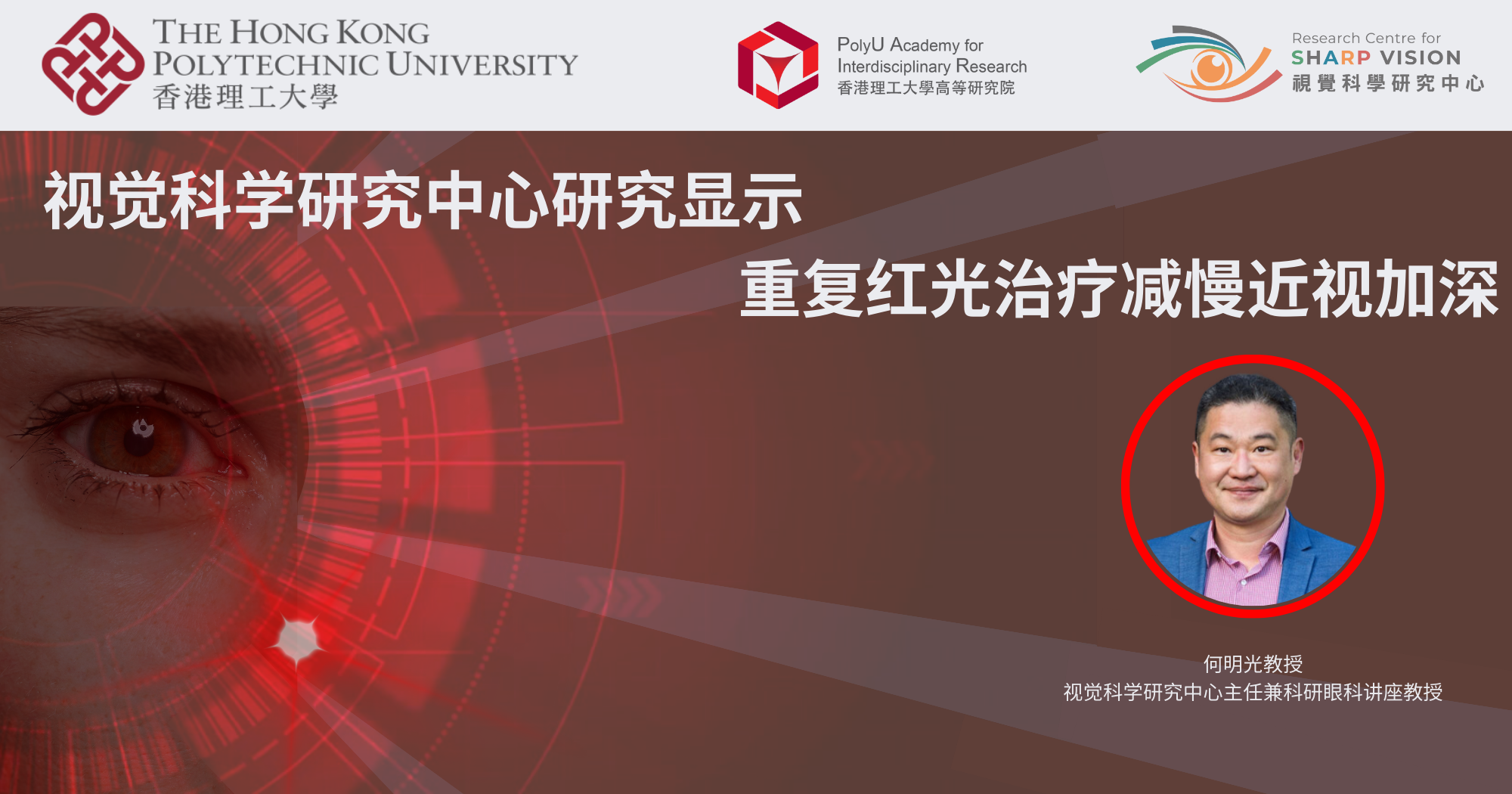 RCSV research shows efficacy of RLRL therapy in controlling myopia_SC