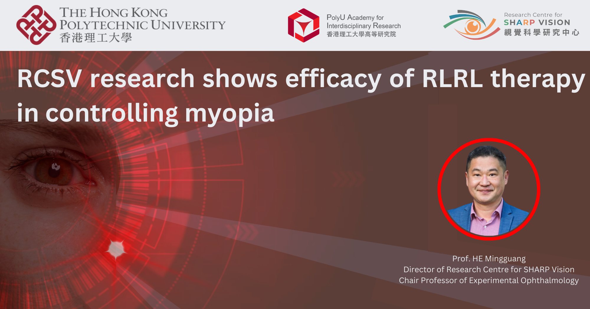 RA01_RCSV research shows efficacy of RLRL therapy in controlling myopia