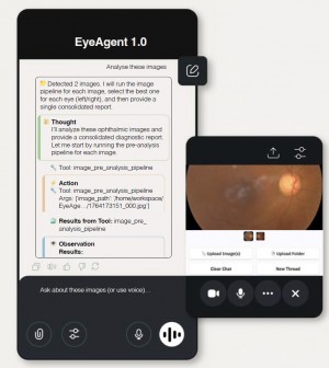 EyeAgent 1.0 is a clinical-grade AI co-pilot system featuring a foundation model, the integration of 50 types of multimodal medical data, and a clinical reasoning simulation framework.