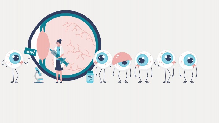Researchers Plan Next-generation AI Co-pilot to Tackle Eye Doctor Shortage 