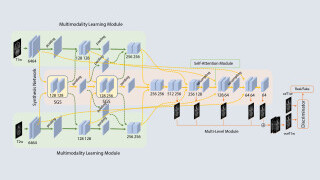 A Progressive Evolution in Virtual MRI Imaging for Tumour Detection