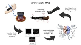 Grasp the Future: AI-powered ProRuka Advancing Prosthetic Hand Control with Sonomyography