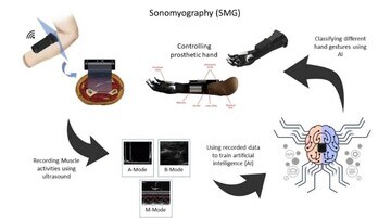 Grasp the Future: AI-powered ProRuka Advancing Prosthetic Hand Control with Sonomyography