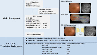 Deep Learning Translates Colour Fundus Photography into Realistic Indocyanine Green Angiography for AMD Screening