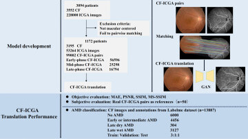 Deep Learning Translates Colour Fundus Photography into Realistic Indocyanine Green Angiography for AMD Screening