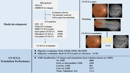 Deep Learning Translates Colour Fundus Photography into Realistic Indocyanine Green Angiography for AMD Screening