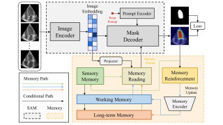 MemSAM: Innovating Echocardiography Video Segmentation with Temporal and Noise-resilient Techniques for Refined Cardiovascular Diagnostic Imaging