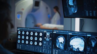 Beyond BMI: How Fat Distribution Shapes the Ageing Brain