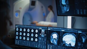 Beyond BMI: How Fat Distribution Shapes the Ageing Brain