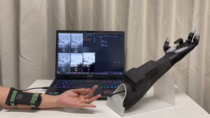 PolyU and BrainCo Collaborate to Scale Deployment and Application of Smart Prosthetics for Amputees