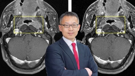 AI technology enables contrast-free MRI procedures 