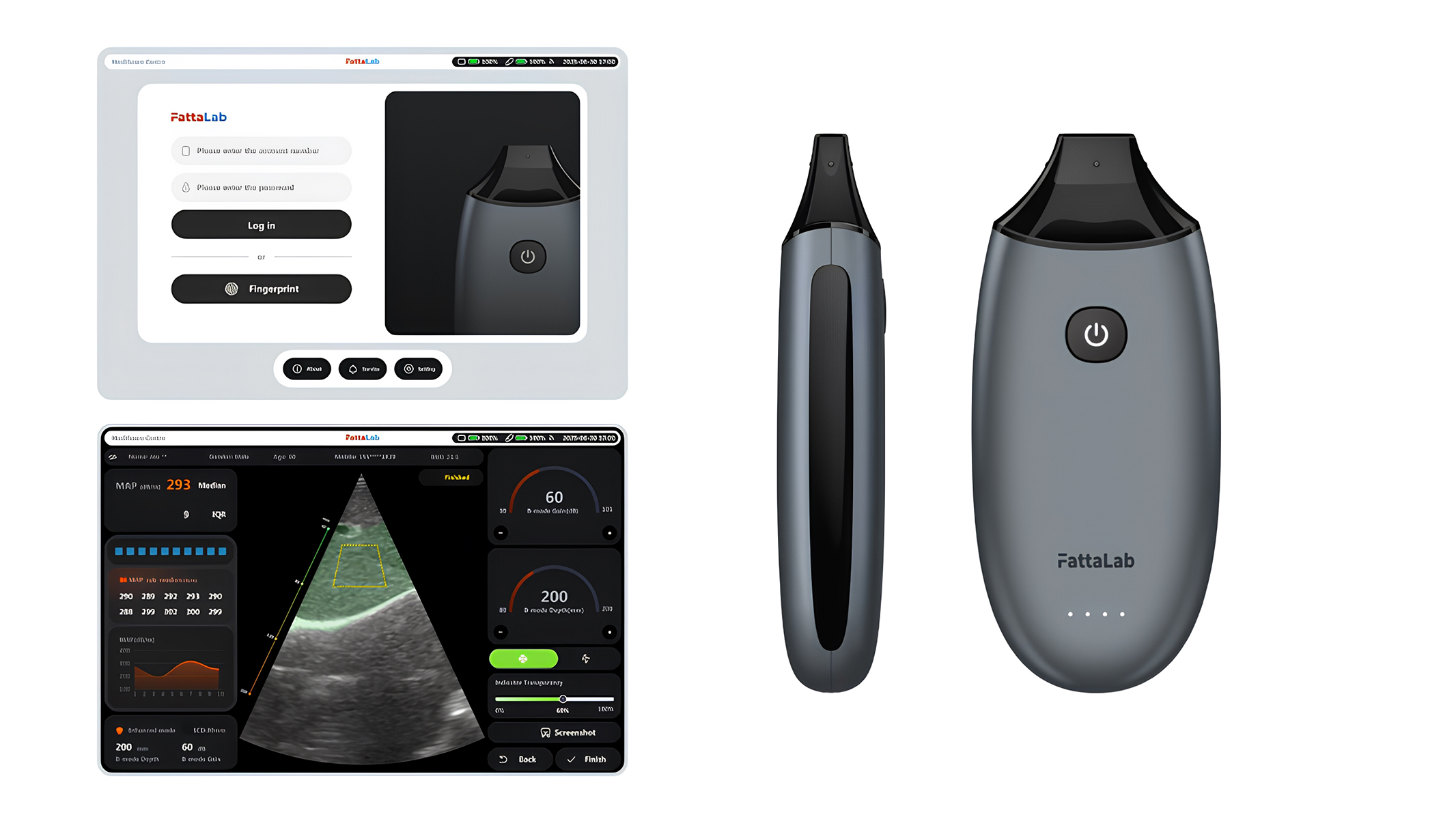 The FattaLab® Fatty Liver Diagnostic Device won an “Innovation Award” in the “Digital Health” category.