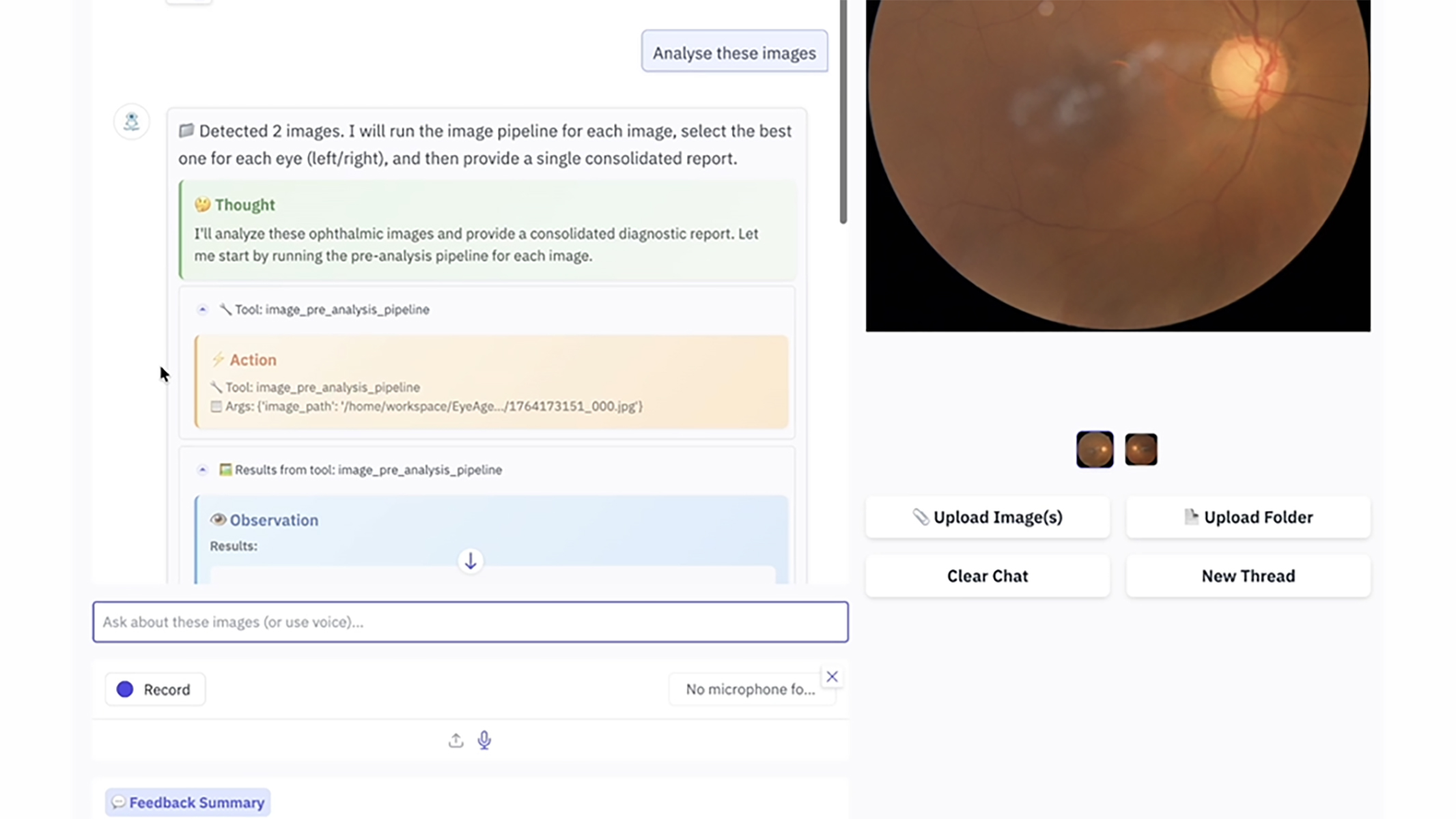 EyeAgent 2.0 is a clinical-grade AI co-pilot system featuring a foundation model, the integration of 50 types of multimodal medical data, and a clinical reasoning simulation framework.