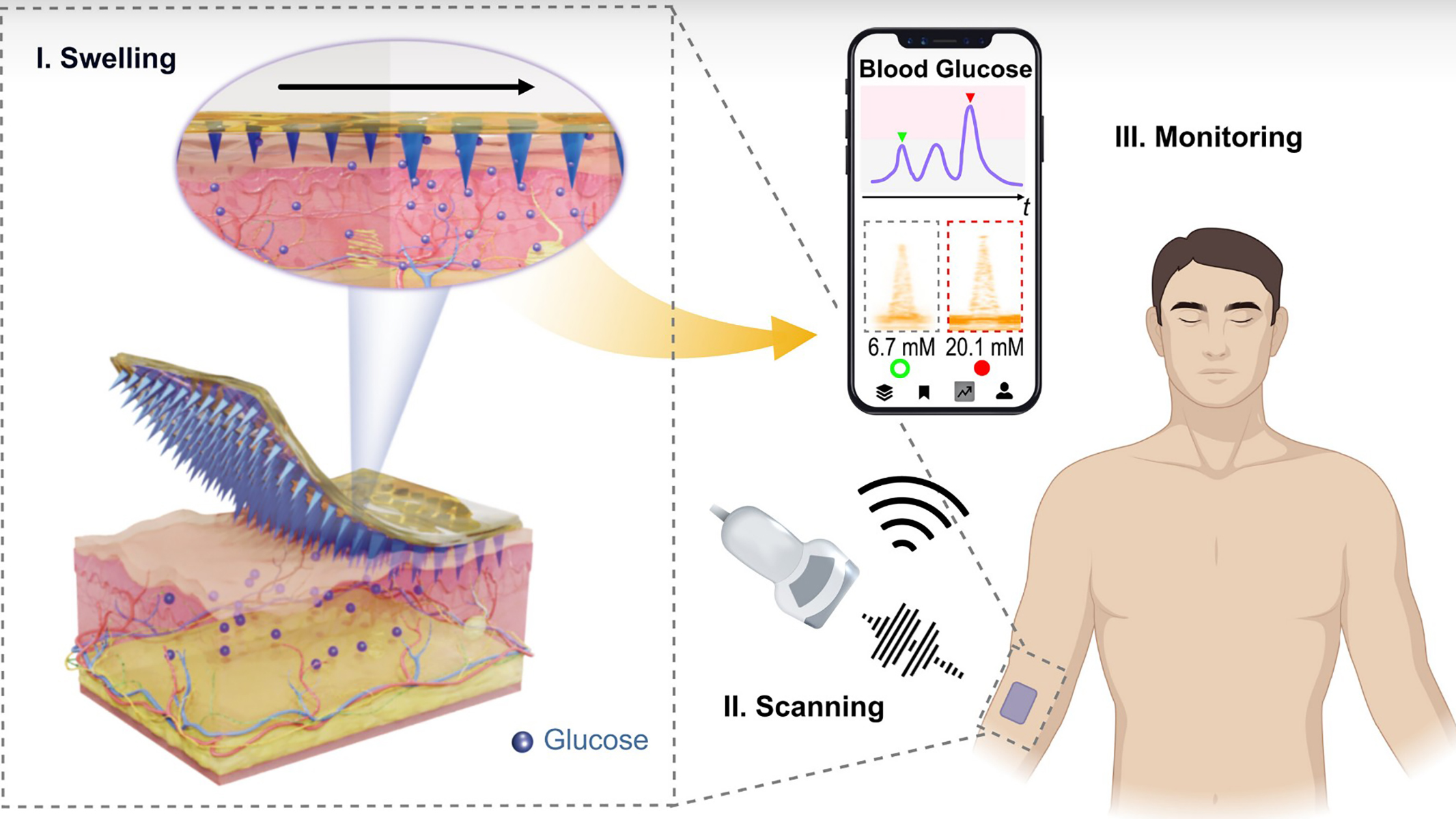 By enabling conventional ultrasound to continuously monitor blood glucose levels, this innovation opens new possibilities for wearable biosensing.