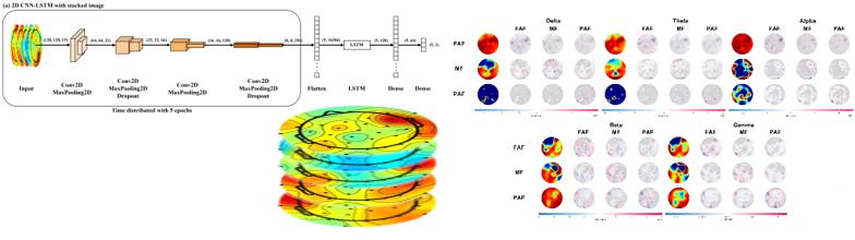 Research illustration: Keeping pilots in the loop: An explainable spatiotemporal EEG-driven deep learning framework for adaptive automation in cruising flight phase.