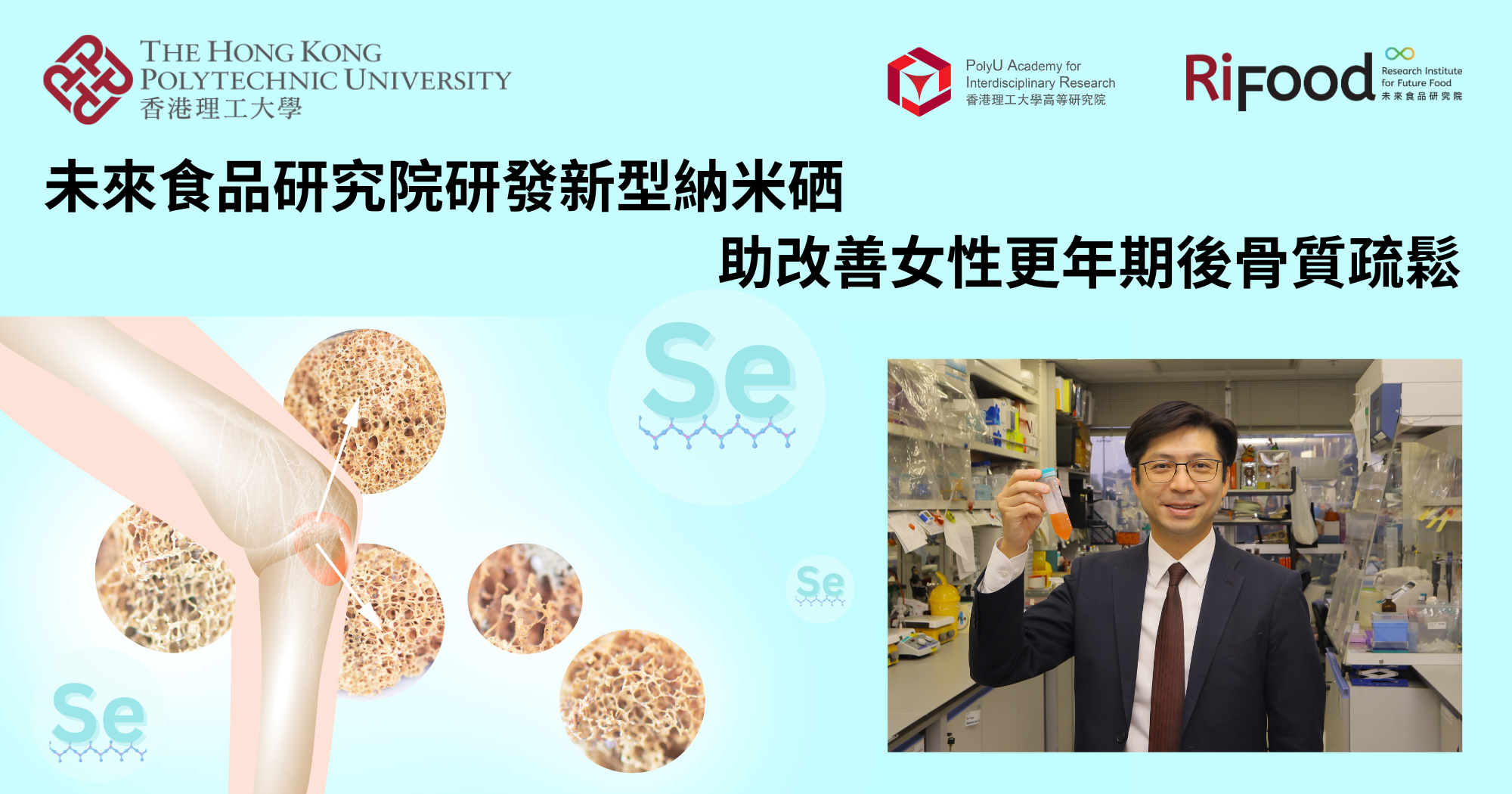 RiFood develops functional selenium nanoparticles for managing postmenopausal osteoporosis_TC