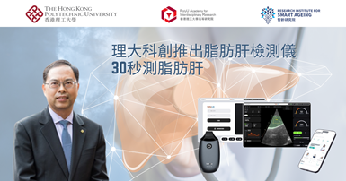 20250705 PolyU start-up launches fatty liver detection device_TC