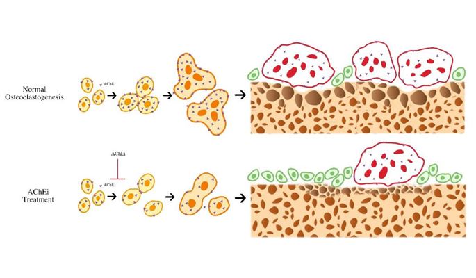 AChEIs for osteoporosis treatment_L