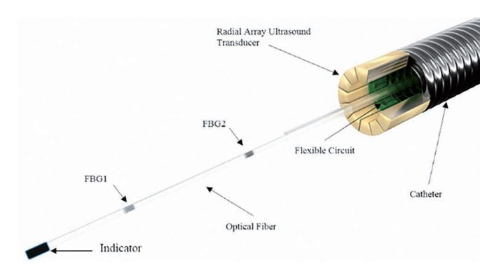 Ultrasound imaging fiber optic pressure sensing composite catheter for cardiovascular disease diagn