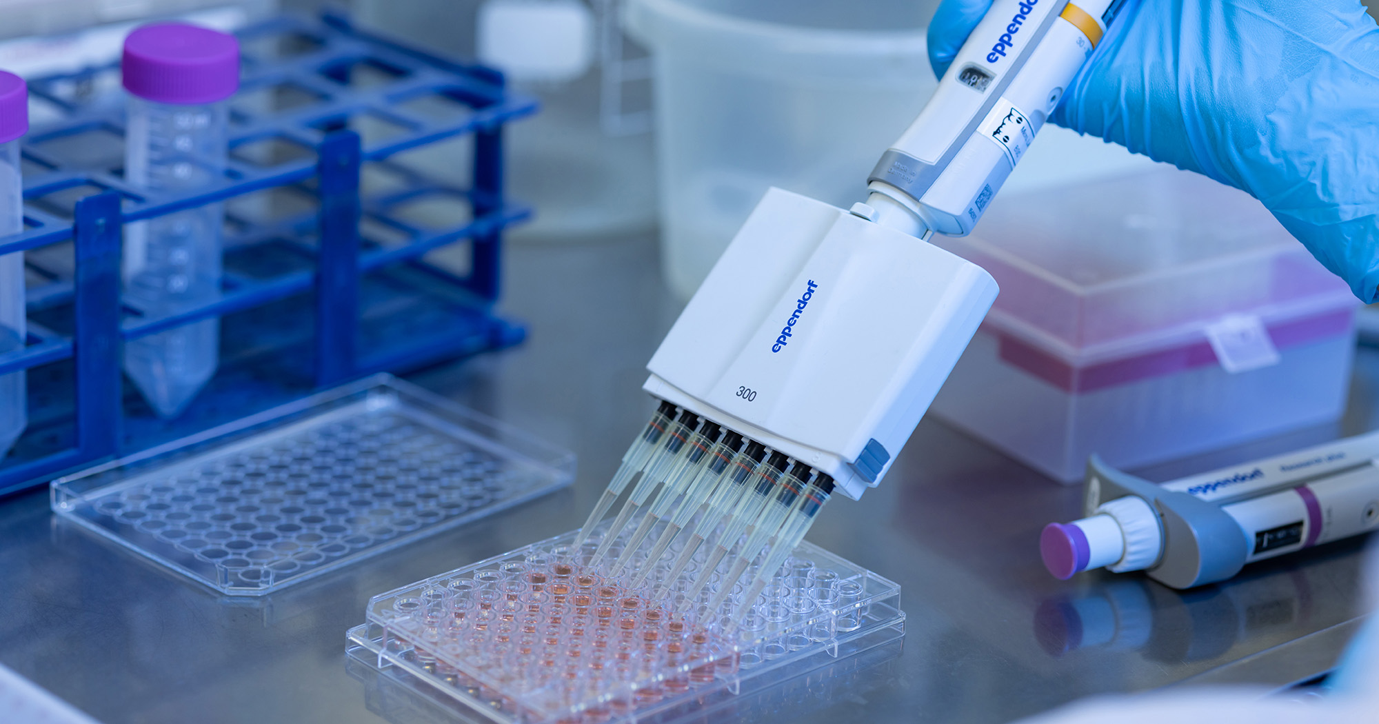 PolyU research unveils hidden microbial threats to ecosystem caused by ...