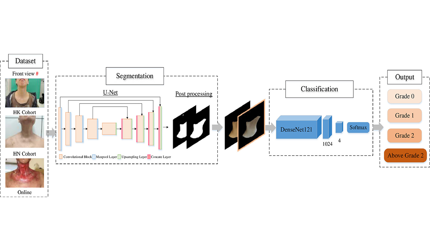 6AIEmpowered Radiation Dermatitis RD Severity Automatic Grading System
