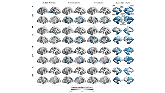 Fat distribution is key to brain health - button