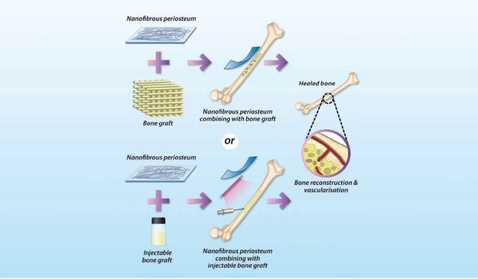 Biomimicking Photocrosslinkable Nanocomposite Bone Graft