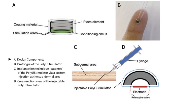 Polyustimulator  Ultrasound driven piezoelectric stimulator for neuromusculoskeletal rehabilitation