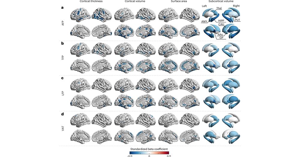 Associations of regional adiposity with cortical and subcortical morphometry. The blue colour indicates negative correlations. a) AFP: arm fat percentage; b) TFP: trunk fat percentage; c) LFP: leg fat percentage; and d) VAT: visceral adipose tissue.