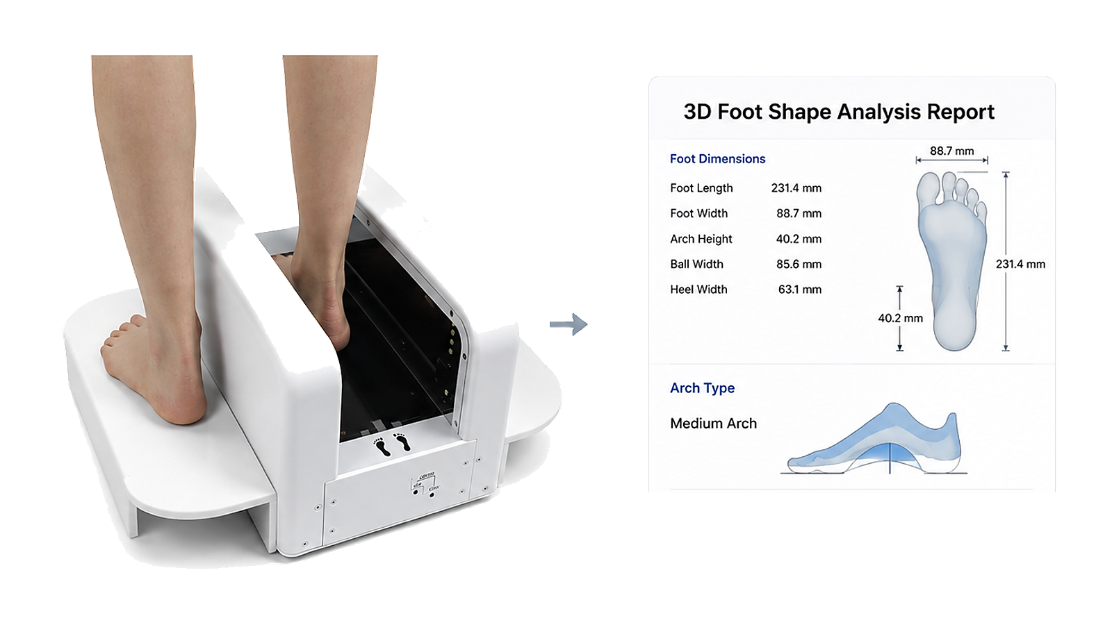 3D foot scan assessment