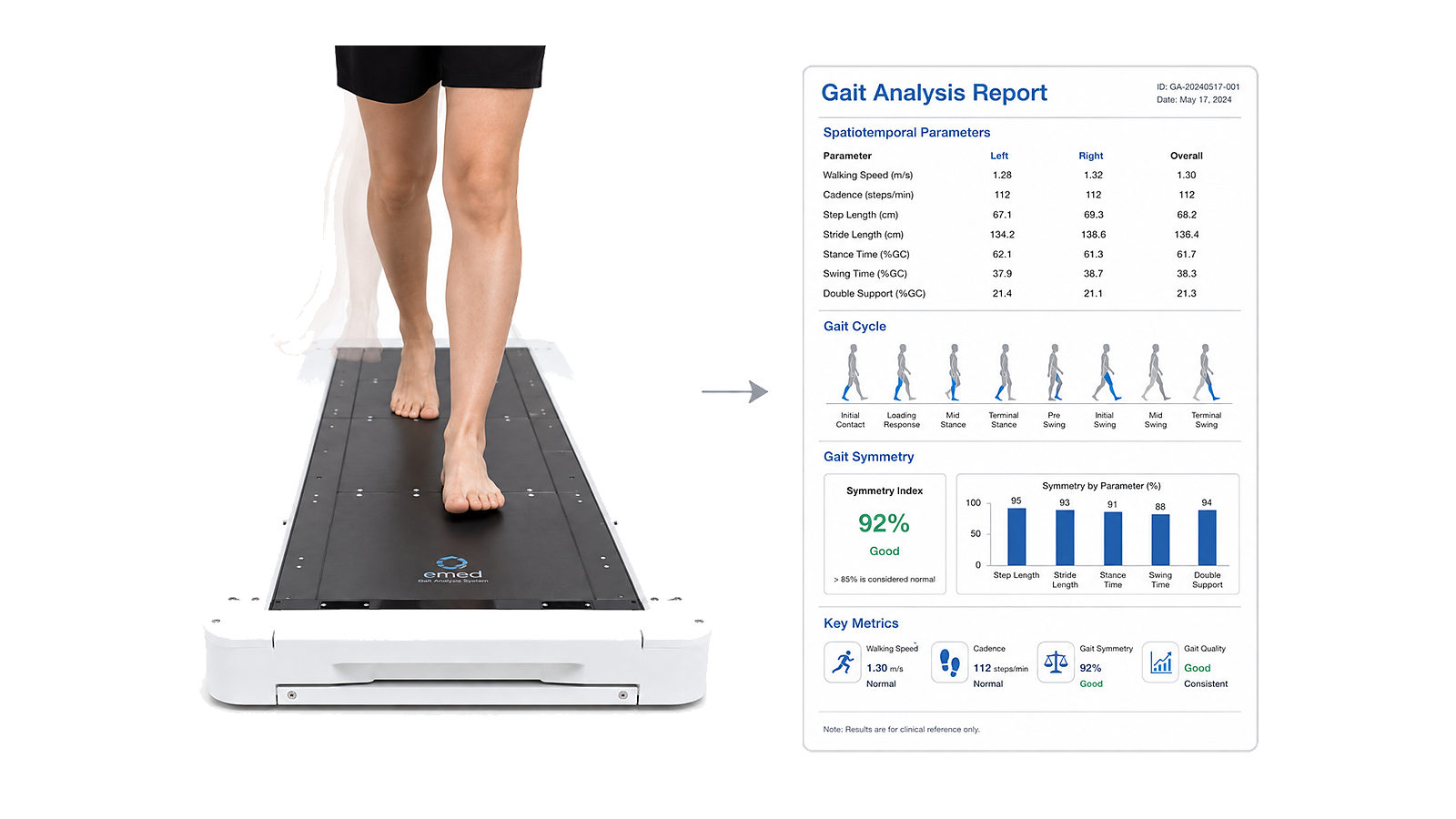 Gait analysis