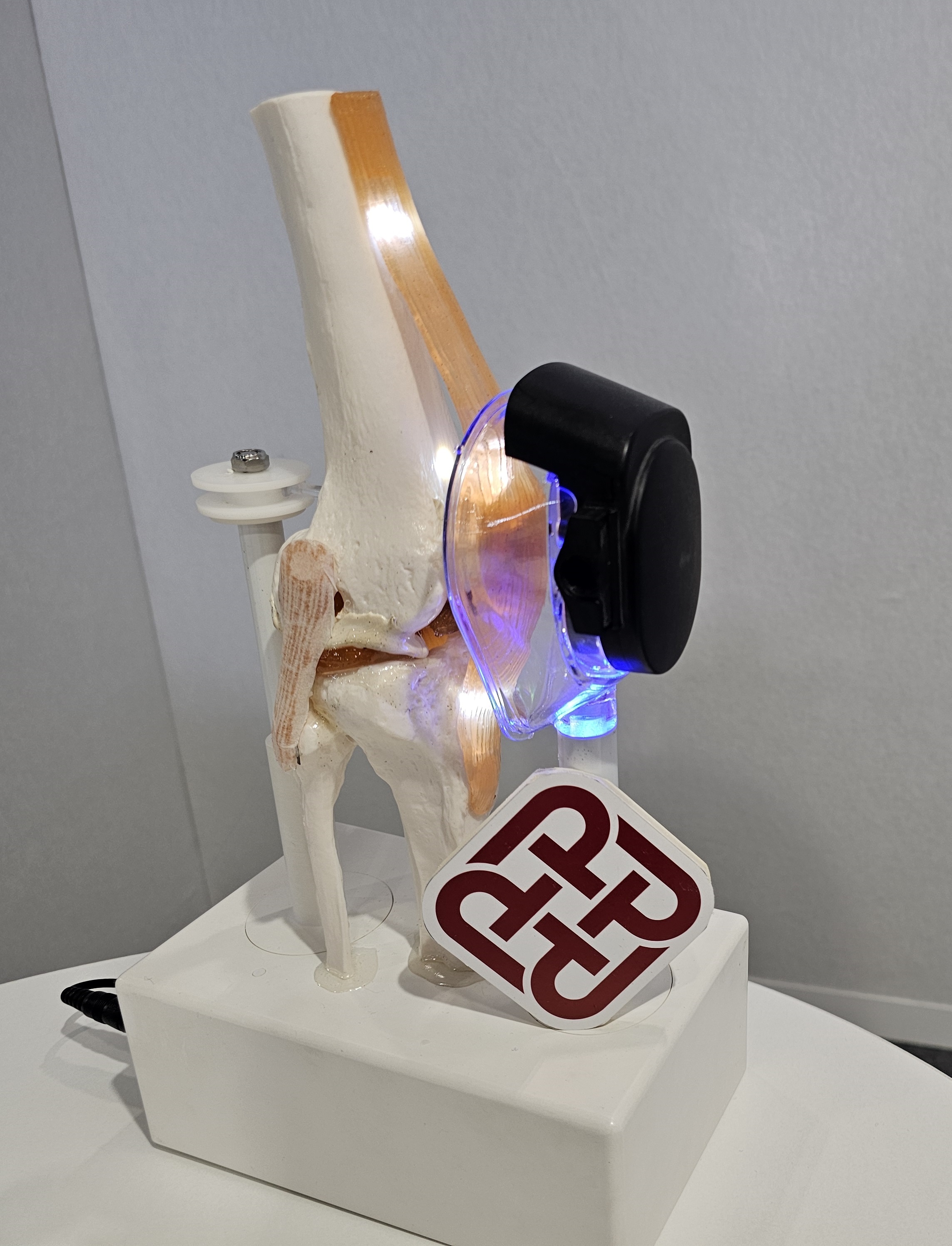 The Patellar Automobilising Device by Prof Amy Fus Team Earns Global Recognition in the 49th Geneva