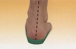 With Orthotics