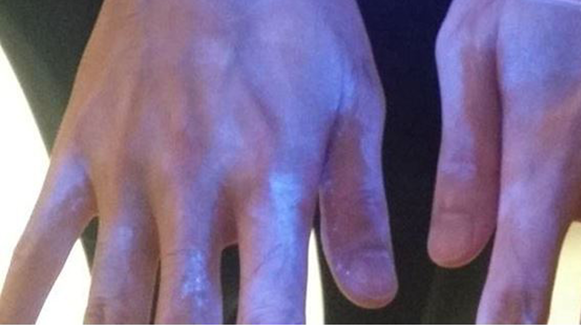 hand-hygiene-skill-training-using-uv-light